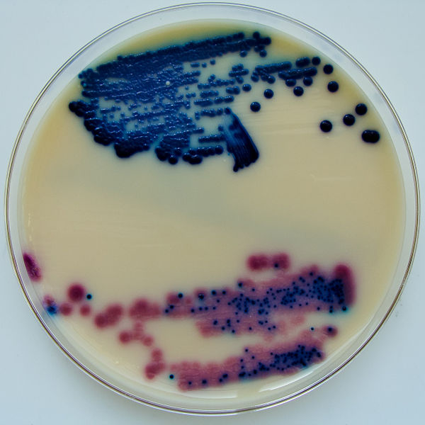 Urine_cultured_on_Oxoid_Brilliance_UTI_Agar_plate