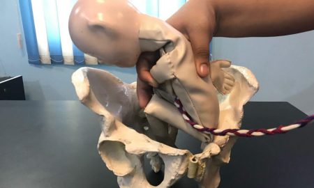 Breech Malpresentation